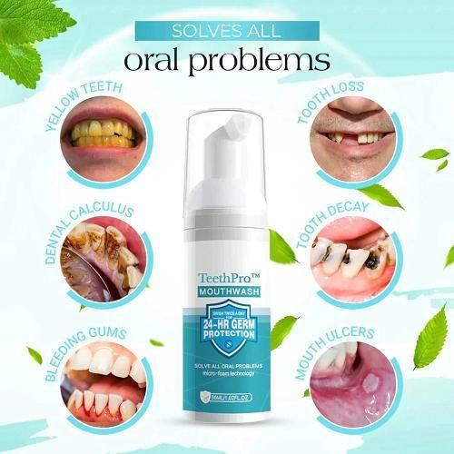 Teeth Whitening Foam 60ML (BUY 1 GET 1 FREE)